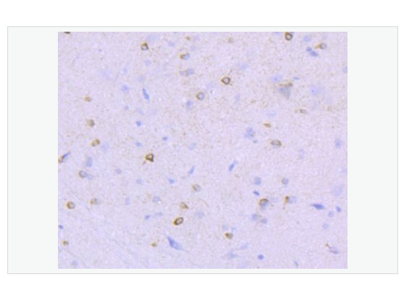 Anti-NMDAR1 antibody-离子型谷氨酸受体1重组兔单克隆抗体