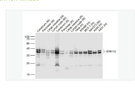 Anti-ERK1/2 antibody-丝裂原活化蛋白激酶1/ERK 1/2重组兔单克隆抗体