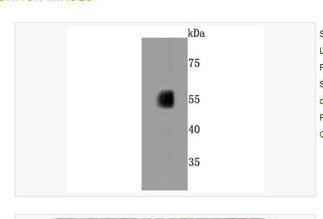 Anti-CYP2E1 antibody-细胞色素P450ⅡE1重组兔单克隆抗体