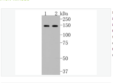 Anti-GLI1 antibody-脑胶质瘤相关蛋白重组兔单克隆抗体