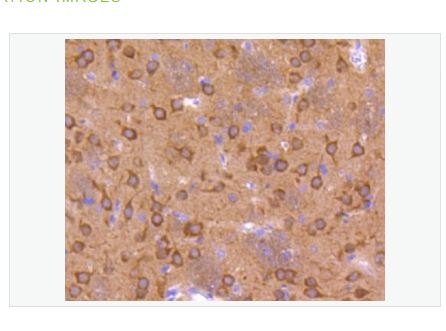 Anti-phospho-GSK3 Alpha + Beta antibody-磷酸化糖原合酶激酶3α/β重组兔单克隆抗体