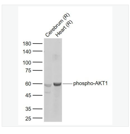 Anti-phospho-AKT1  antibody-磷酸化蛋白激酶AKT1抗体