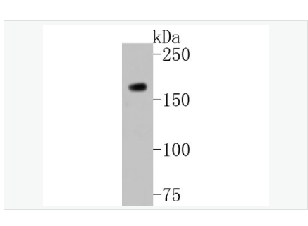 Anti-HDAC9 antibody-组蛋白去乙酰化酶9重组兔单克隆抗体