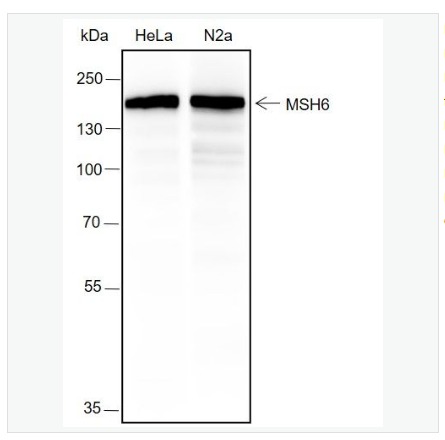 Anti-MSH6 antibody-错配修复蛋白6重组兔单克隆抗体