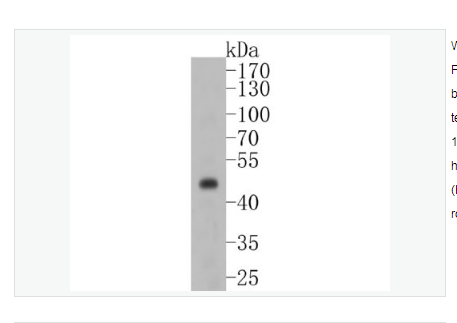 Anti-PAX8 antibody-配对盒基因8重组兔单克隆抗体