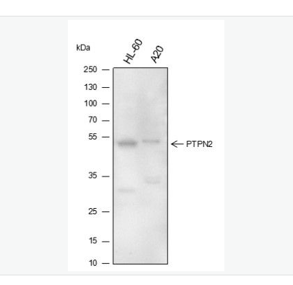 Anti-PTPN2 antibody-酪氨酸蛋白磷酸酶非受体2型单克隆抗体