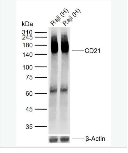 Anti-GART  antibody-甘氨酰胺核苷酸合成酶重组兔单克隆抗体