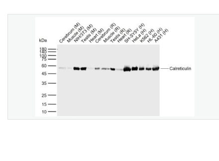 Anti-Calreticulin  antibody-钙网蛋白重组兔单克隆抗体