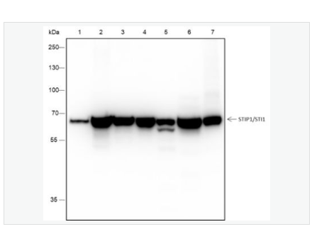 Anti-STIP1   antibody-应激诱导磷蛋白1重组兔单克隆抗体