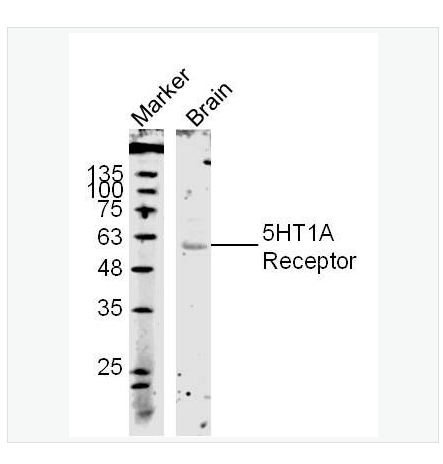 Anti-5HT1A Receptor antibody-5-羟色胺受体1A抗体