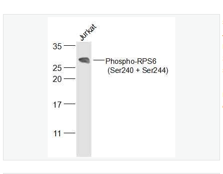 Anti-Phospho-RPS6 antibody-磷酸化S6核糖体蛋白(Ser240/244)抗体