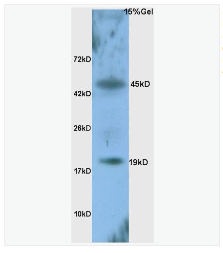 Anti-ATF3 antibody-活化转录因子3抗体