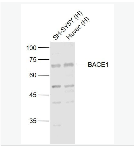 Anti-BACE1  antibody-β分泌酶抗体