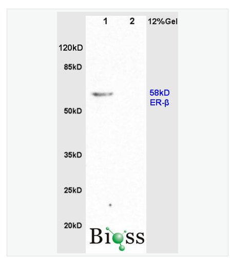 Anti-Estrogen Receptor alpha + betaantibody-雌激素受体α/β抗体