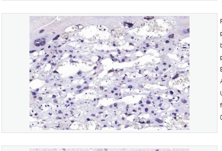 Anti-BRCA2  antibody-乳腺癌易感基因2抗体