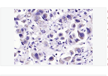 Anti-CAPN1 antibody-钙蛋白酶1抗体