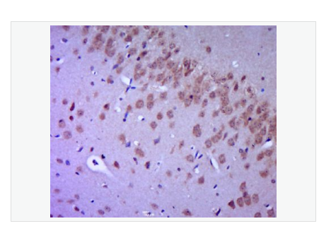 Anti-FGFR2  antibody-成纤维细胞生长因子受体2抗体