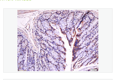 Anti-Fibronectin/FN1 antibody-纤维连接蛋白抗体