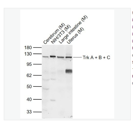 Anti-Trk A + B + C antibody-酪氨酸激酶A/B/C抗体