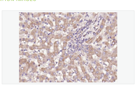 Anti-Ceramide glucosyltransferase antibody-谷氨酸半胱氨酸γ合成酶抗体