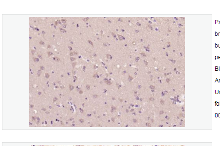 Anti-GLP-2  antibody-胰高血糖素样肽-2抗体