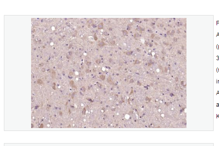 Anti-Glucocorticoid receptor  antibody-糖皮质激素受体抗体