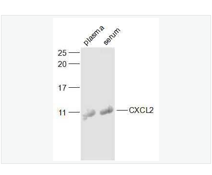 Anti-CXCL2/GRO Beta  antibody-巨噬细胞炎症蛋白2（ GRＯβ）抗体