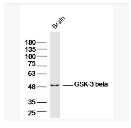 Anti-GSK-3 beta  antibody-糖原合酶激酶-3β抗体