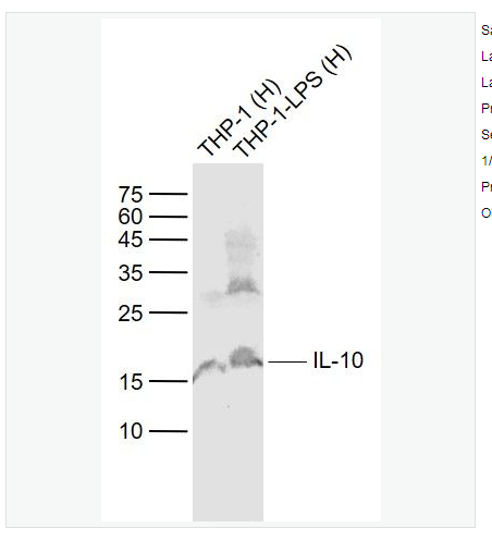 Anti-IL-10 antibody -白细胞介素10抗体