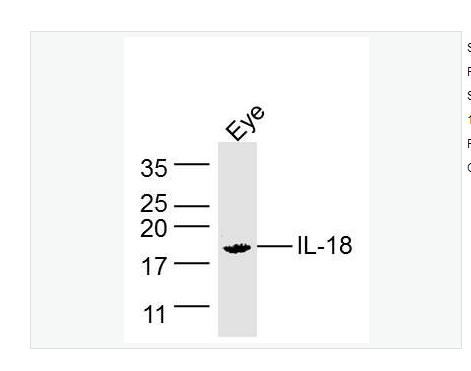 Anti-IL18 antibody-白细胞介素-18/干扰素γ诱导因子抗体