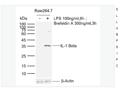 Anti-IL-1 Beta antibody-白介素1β/IL-1β抗体