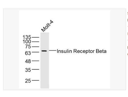 Anti-Insulin Receptor Beta antibody-胰岛素受体β抗体