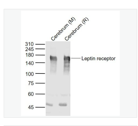 Anti-Leptin receptor antibody-瘦素受体抗体