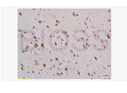 Anti-Nogo R  antibody-轴索过度生长抑制因子受体/Nogo受体抗体