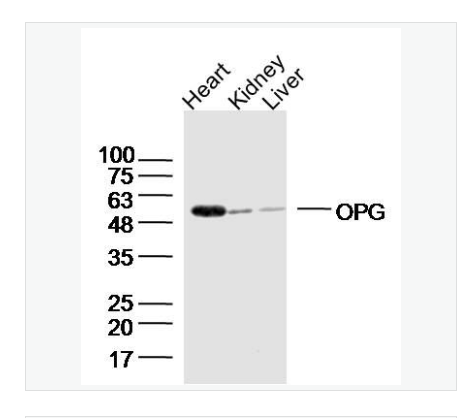 Anti-OPG antibody-骨保护蛋白/护骨素抗体