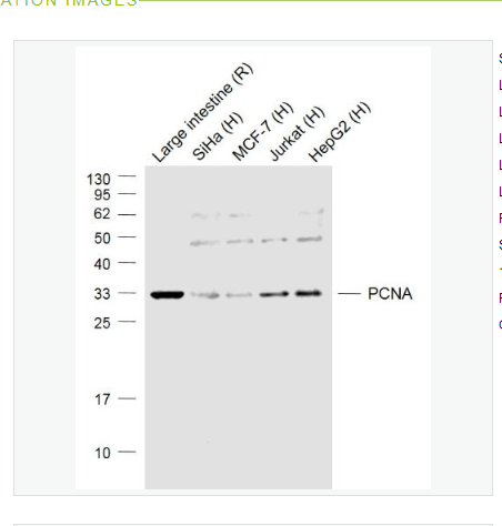 Anti-PCNA (Nuclear Loading Control)  antibody-增殖细胞核抗原（核内参）抗体