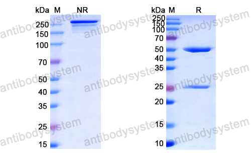 抗体：Human parvovirus B19/HPV-B19 VP2/Viral protein 2 Antibody (SAA0341) RVV16901