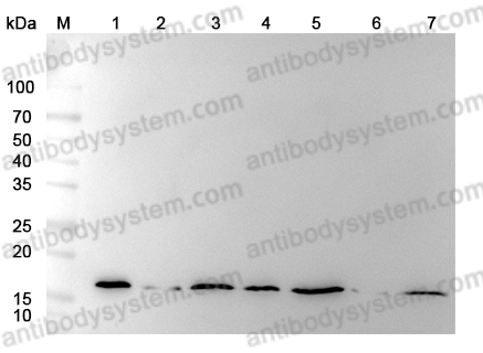 Anti-Hypusine antibody (Hpu24)RGK08101