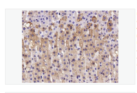 Anti-Substance P antibody-P物质抗体