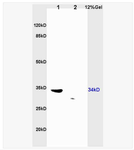 Anti-TRADD antibody-肿瘤坏死因子受体1相关死亡域蛋白抗体