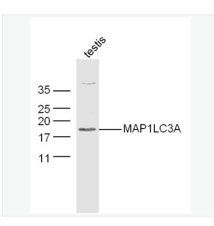 Anti-MAP1LC3A antibody-自噬微管相关蛋白轻链3抗体