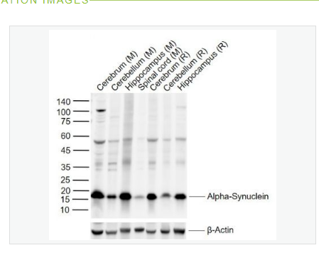 Anti-SNCA  antibody-核突触蛋白-α（N端）抗体