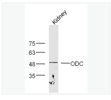 Anti-ODC1 antibody-鸟氨酸脱羧酶抗体