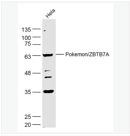 Anti-Pokemon/ZBTB7A  antibody-扑克蒙蛋白抗体