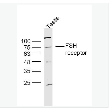 Anti-FSH receptor antibody-促卵泡刺激素受体抗体