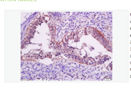 Anti-Mutant p53 antibody- 突变型P53抗体