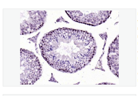 Anti-Histone H1.4  antibody-乙酰化组蛋白H1b抗体