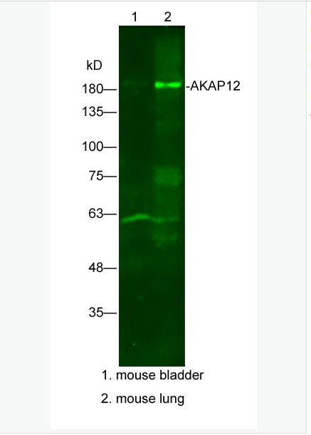 Anti-AKAP12 antibody-丝氨酸抑制蛋白激酶C底物抗体