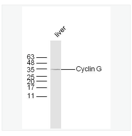 Anti-Cyclin G antibody-周期素G抗体