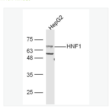 Anti-HNF1A antibody-肝细胞核因子1α抗体